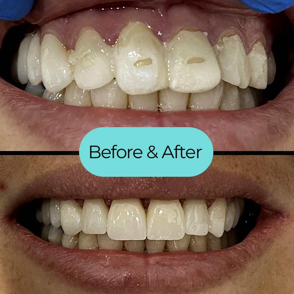 Transformative Dentistry in Costa Rica: Cosmetic and Full Mouth Restoration Services