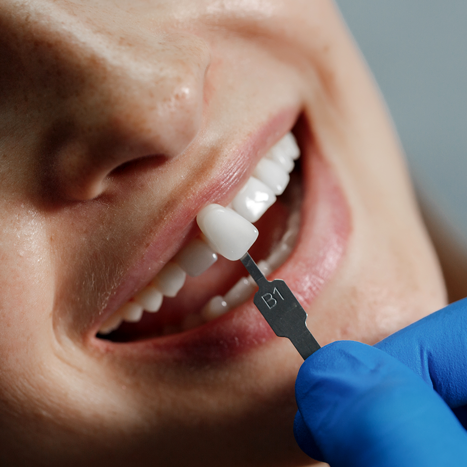 Discover excellence in dental care at Dr. Li Chen's Costa Rican clinic.