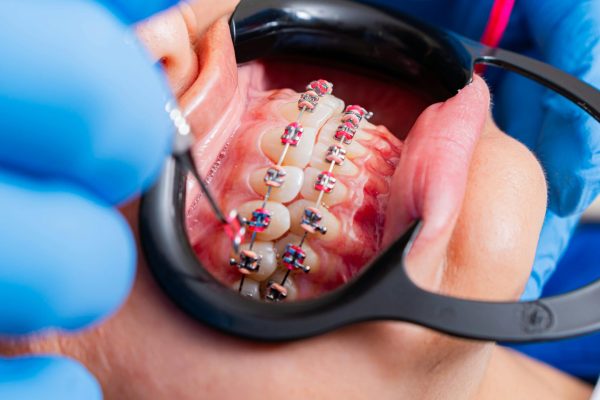 Orthodontic treatment for children, teenagers, and adults.